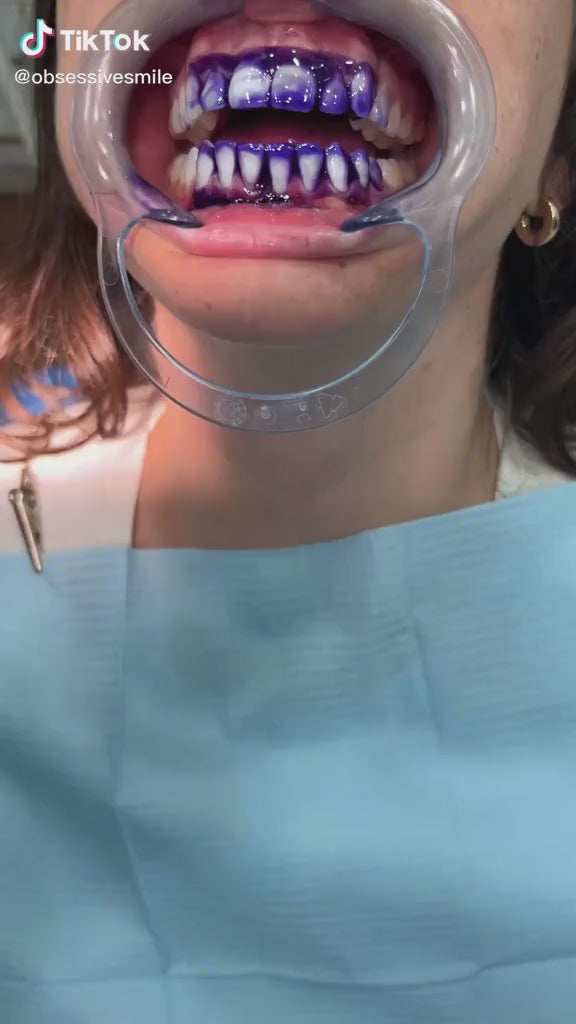 GlowWhite™ Sonrisa radiante instantánea